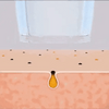 Blackhead remover apparaat 2024 – verwijdert mee-eters en overtollig talg in slechts 5 minuten