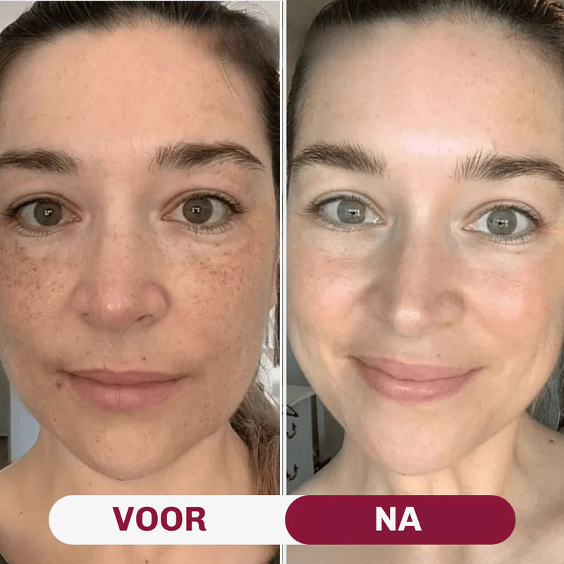 Collageen masker tegen rimpels – helpt de huid gladder en voller te laten ogen na regelmatig gebruik