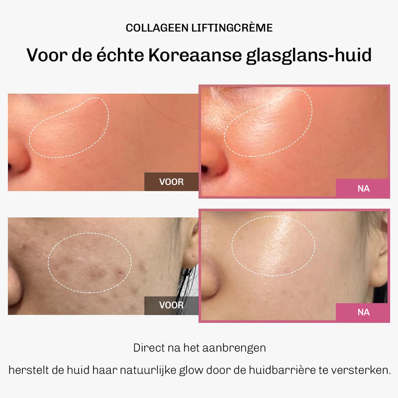 Verstevigende collageencrème voor dagelijks gebruik – geschikt als dag- en nachtverzorging
