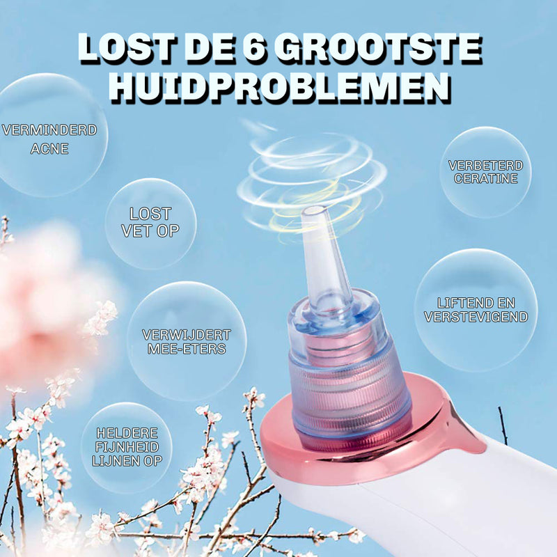 Elektrische blackhead remover – verwijdert mee-eters, puistjes en vuil effectief thuis