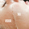 Gezichtshaar verwijderen vrouw – zachte verwijdering van peach fuzz zonder huidirritatie