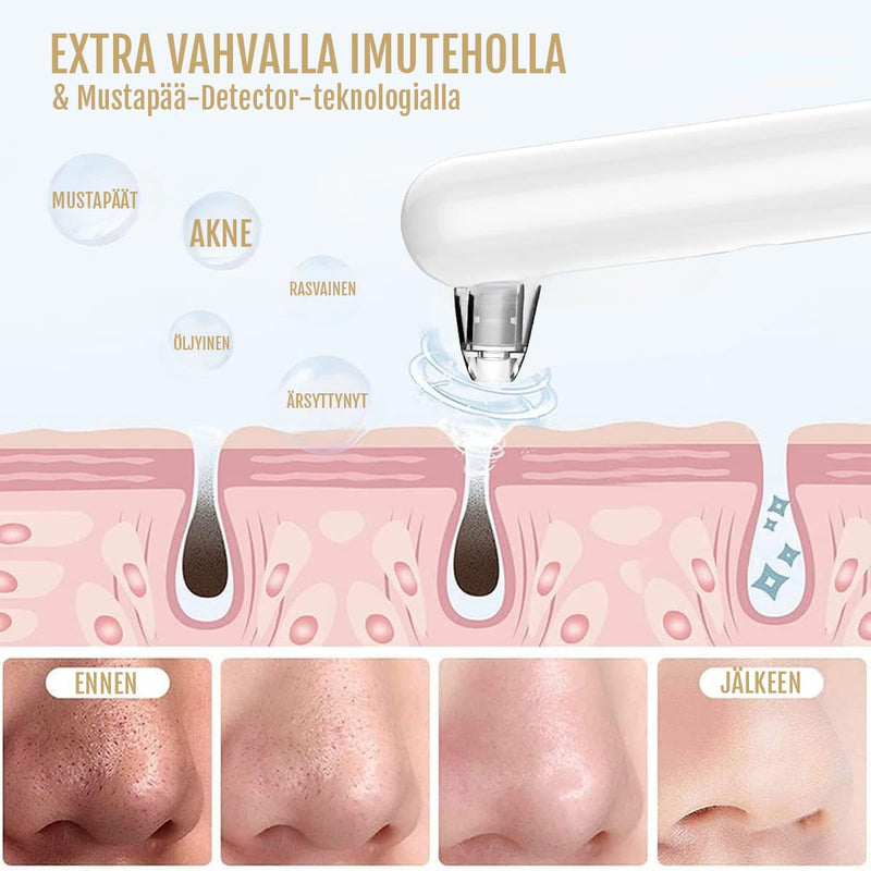 Mustapäiden poistopakkaus kameralla