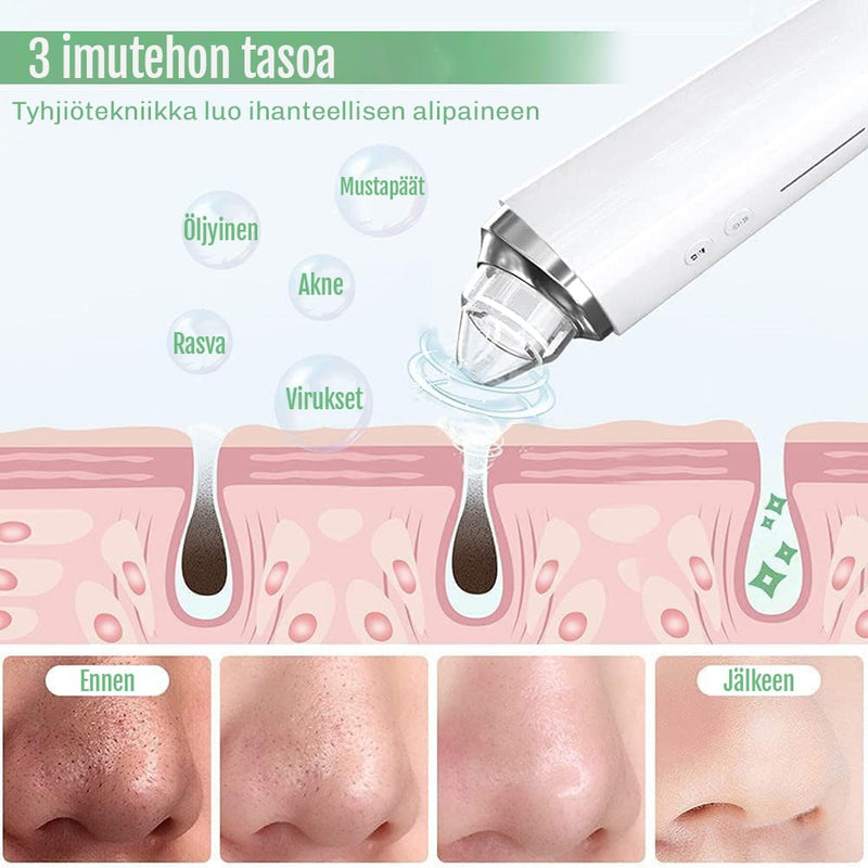 Mustapäiden poistopakkaus kameralla