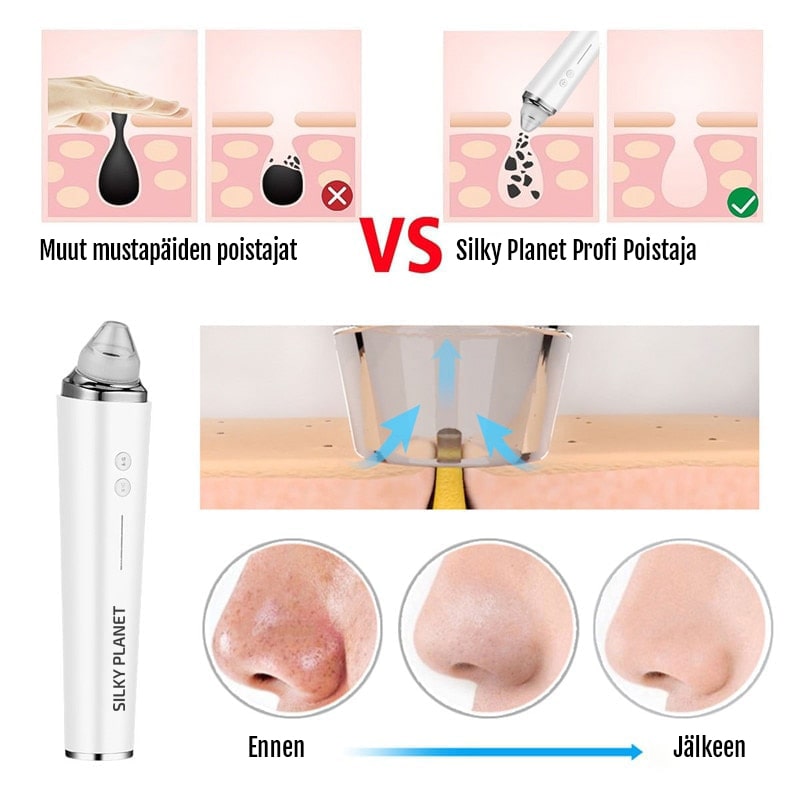 Mustapäiden poistopakkaus kameralla