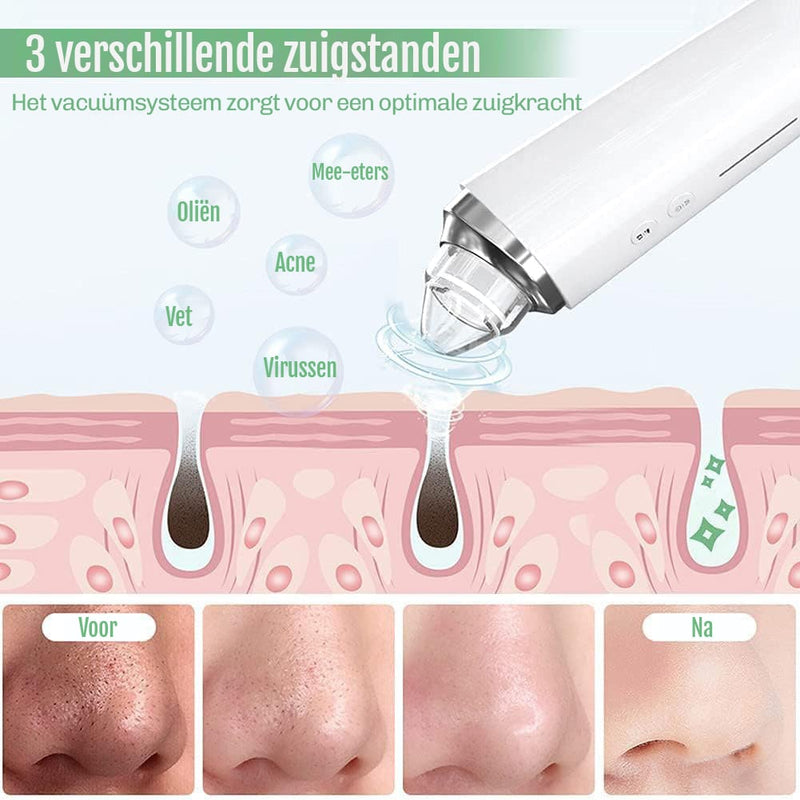 Mee-eter zuiger met drie zuigstanden en zes opzetstukken voor verschillende huidtypes