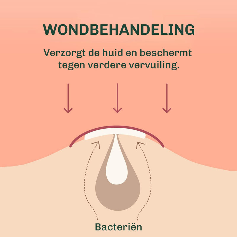 Onzichtbare puistjespleister met matte afwerking – geschikt voor gebruik overdag en ’s nachts
