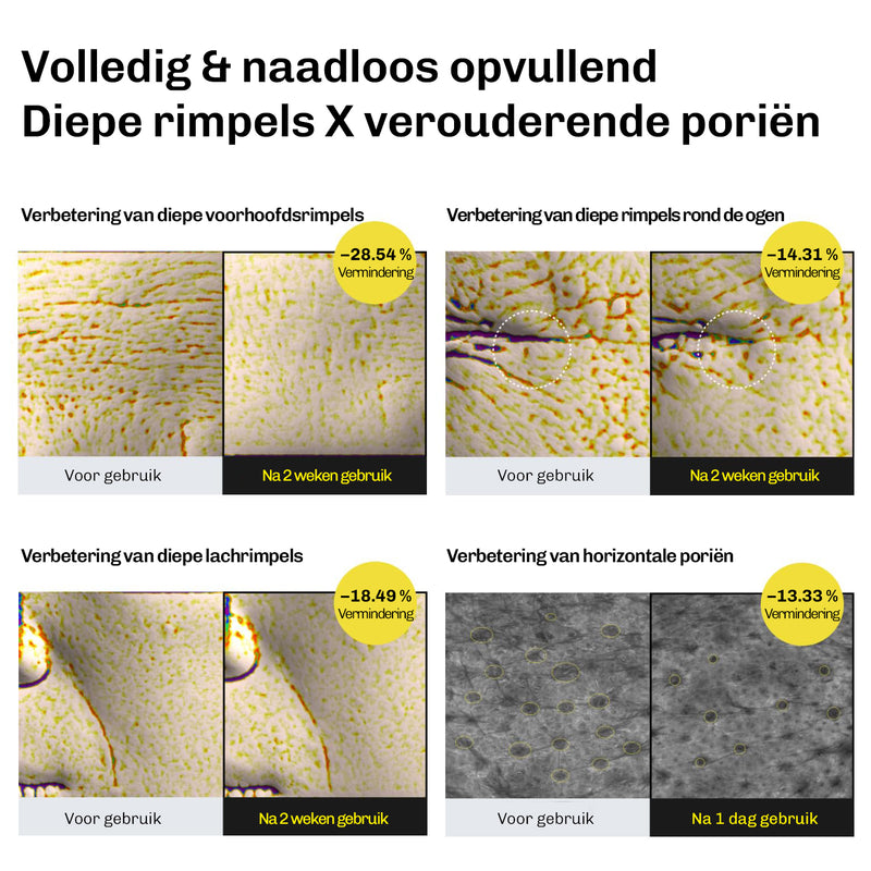 Retinal serum tegen fijne lijntjes – helpt de huid gladder en voller te laten ogen