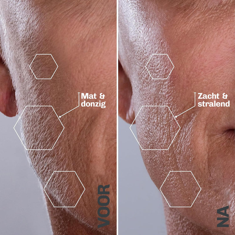 SILKYFLASH+ set met vervangmesjes, oplaadkabel en Hair Identifier Spray