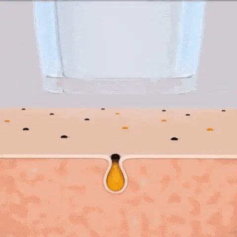 Professional Pormasksug