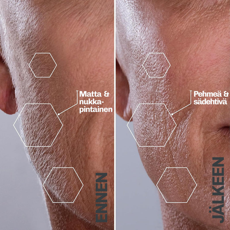 Ultraäänikarvanpoistolaite SILKYFLASH+