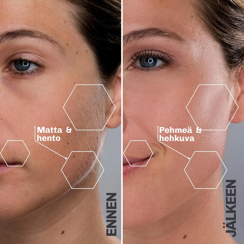 Ultraäänikarvanpoistolaite SILKYFLASH+