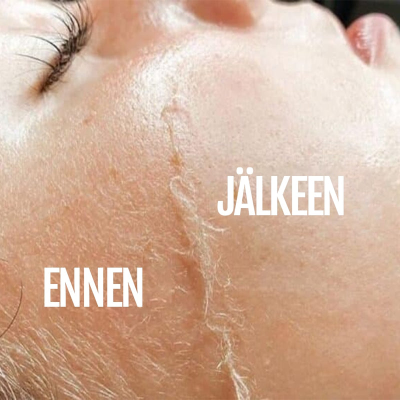 Ultraäänikarvanpoistolaite SILKYFLASH+