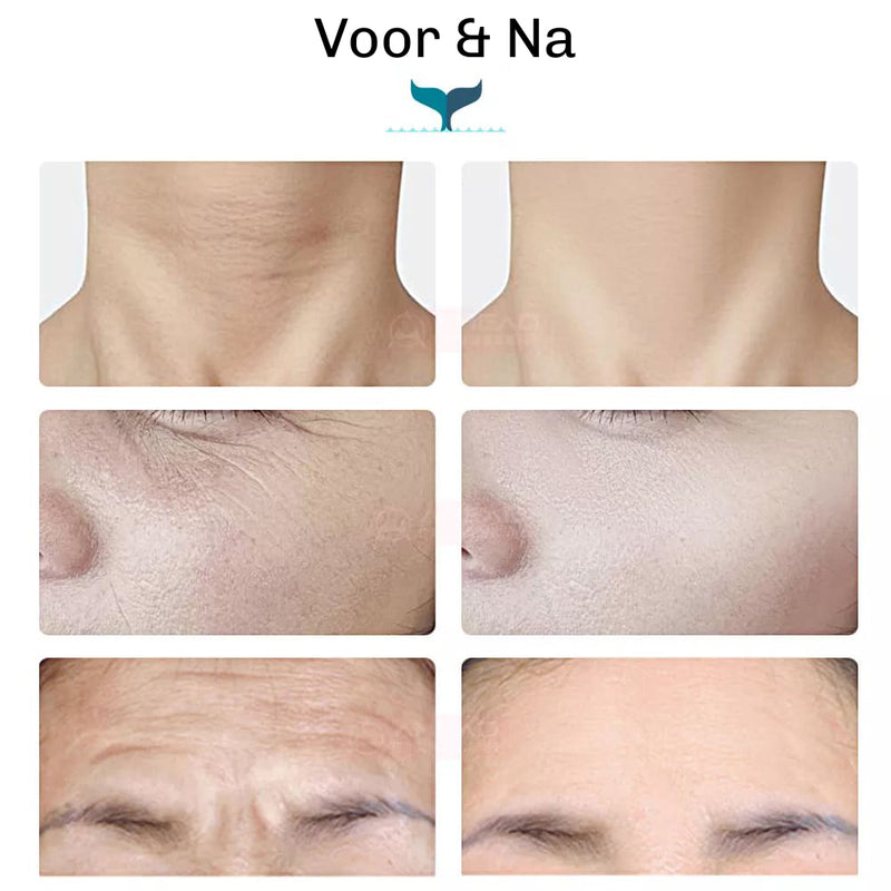 SilkyPlanet LumiFace EMS facelift apparaat – combineert lifting, LED therapie en huidversteviging