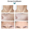 SilkyPlanet Lumiface EMS facelift laite – tehokas ratkaisu kiinteämpään ja nuorekkaampaan ihoon kotona