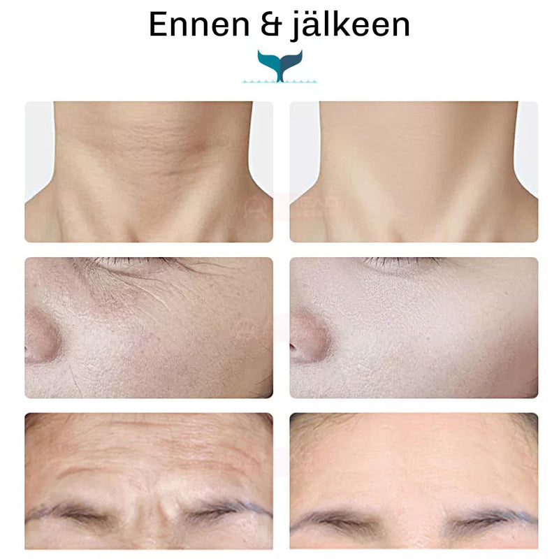 SilkyPlanet Lumiface EMS facelift laite – tehokas ratkaisu kiinteämpään ja nuorekkaampaan ihoon kotona