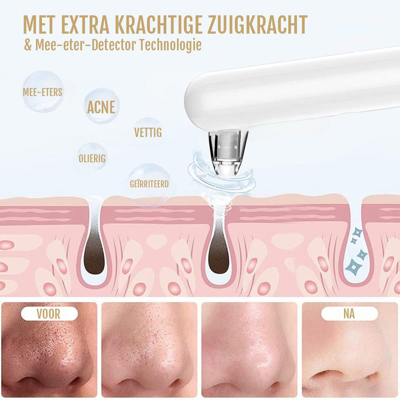 SilkyPlanet mee-eter verwijderaar met camera – professionele poriënreiniging thuis