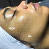 SilkyPlanet SILKYFLASH+ dermaplaning apparaat – veilige en effectieve gezichtsverzorging voor thuis