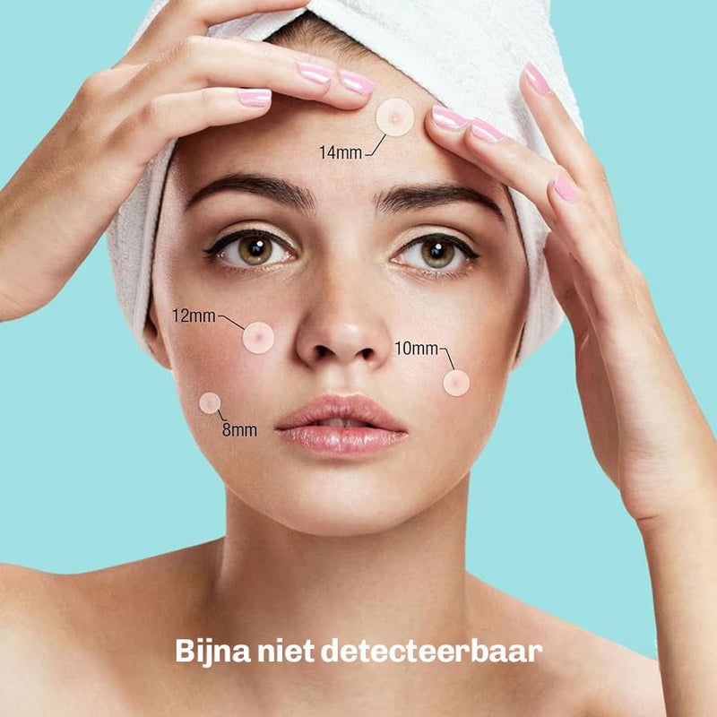 SilkyPlanet acne patches – dunne randen voor perfecte aansluiting op de huid