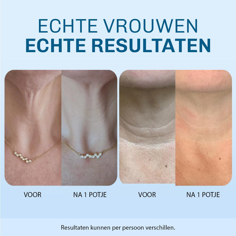 SilkyPlanet verstevigende halscrème close-up – lichte formule die snel intrekt en zijdezacht aanvoelt