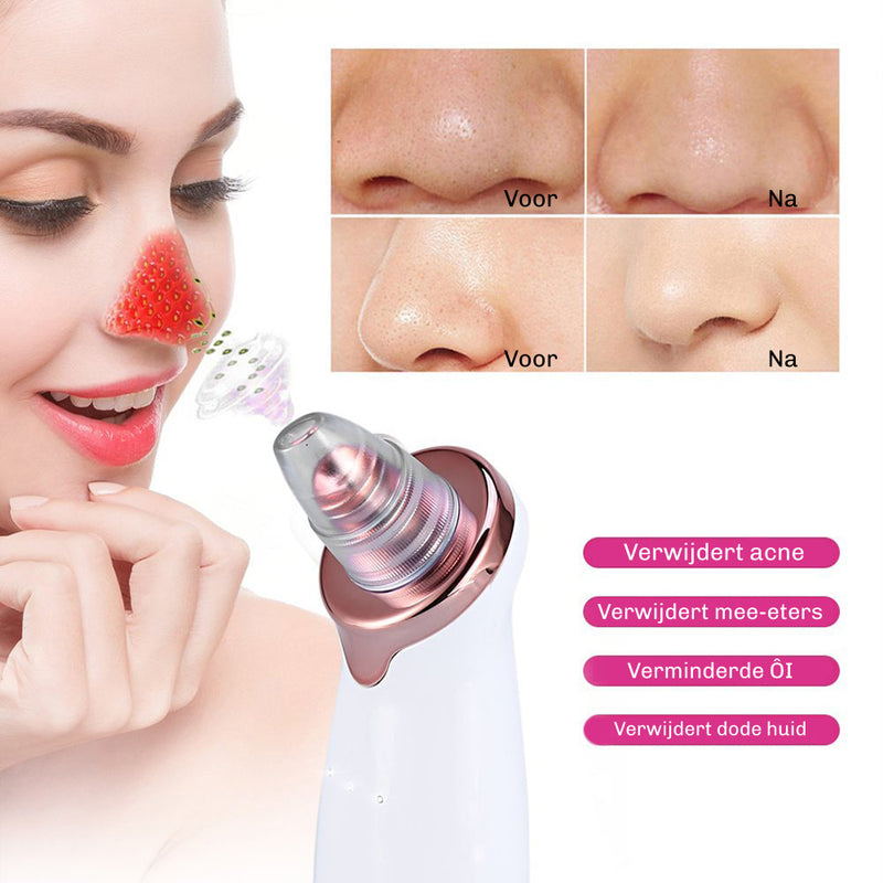 SilkyPlanet SkinClear 3 – helpt poriën diep te reinigen en huidstructuur te verbeteren