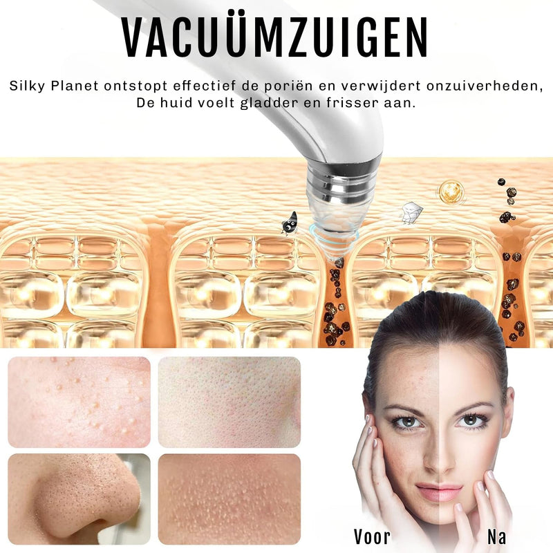 Vacuüm huidreiniger met krachtige zuigtechnologie – verwijdert onzuiverheden effectief