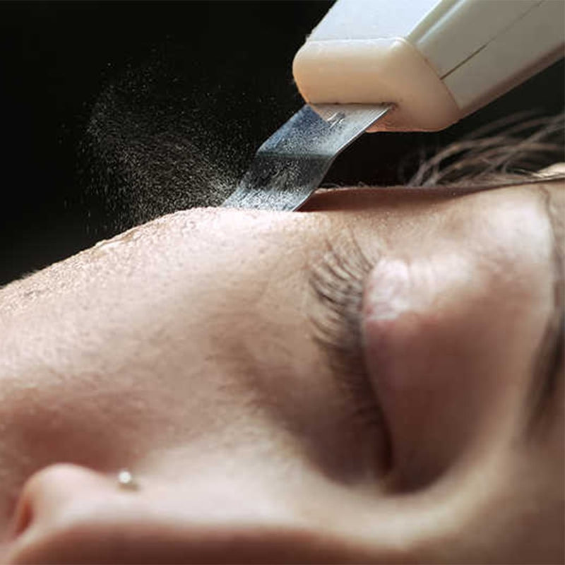 Ennen–jälkeen: kirkkaampi, sileämpi ja tasaisempi iho säännöllisen käytön jälkeen