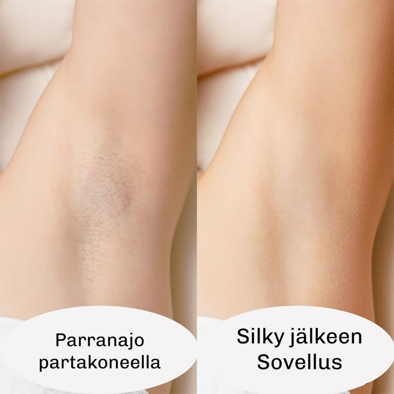 Silky 2.0 IPL-karvanpoistolaite