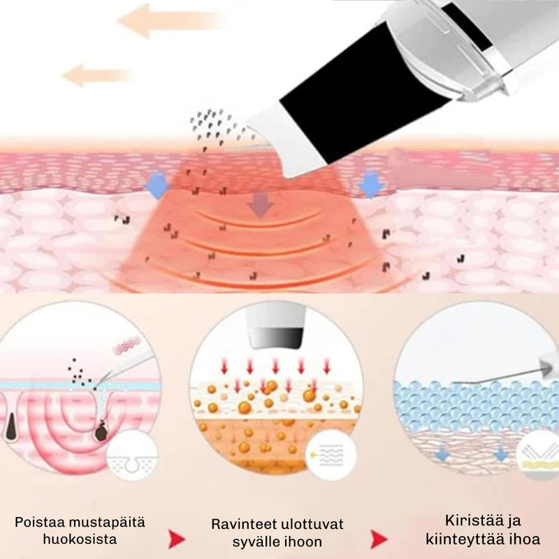 DermaGlow 5 Ultrasone Gezichtsreiniger