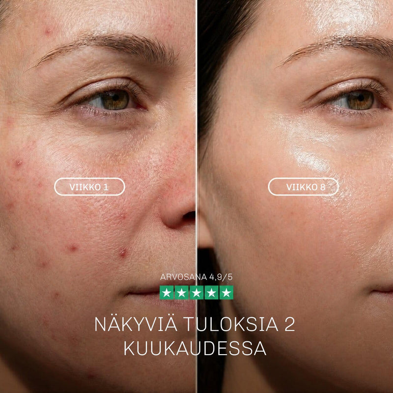 LED maski LumiWhite mukana kaula ja dekoltee hoitoosa