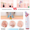 Lahjaidea: SkinClear 3 -mustaheadpoistaja kotikäyttöön