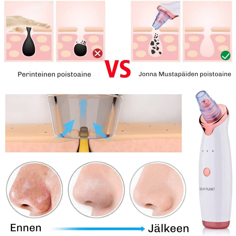 Lahjaidea: SkinClear 3 -mustaheadpoistaja kotikäyttöön