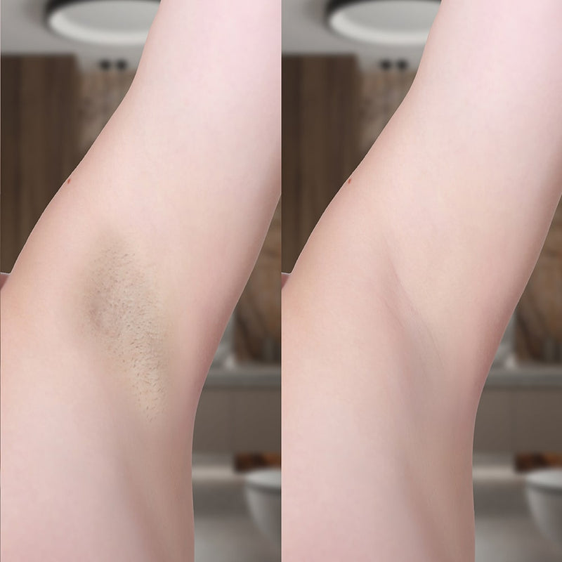 IPL Haarentferner für glatte Beine